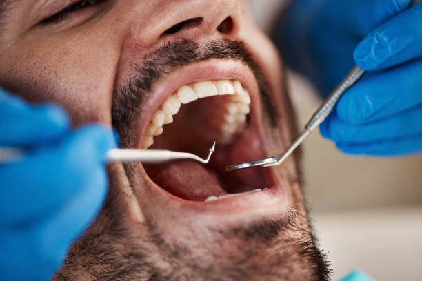 Emergency Dental Services in Middleburg, PA
